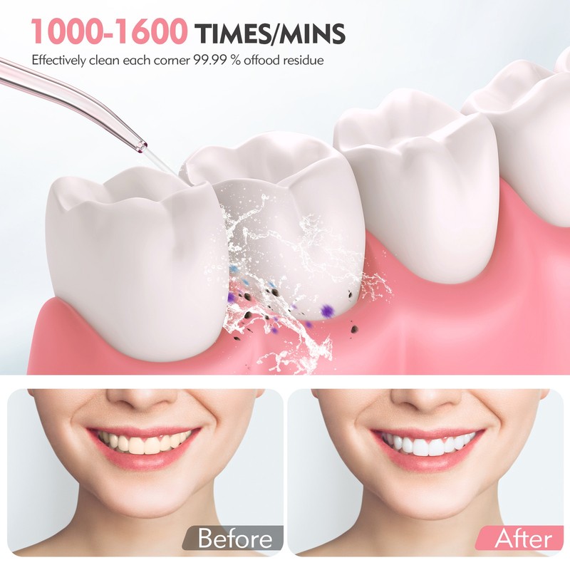 SEJOY Cordless Oral Irrigator For Teeth Water Flosser Dental Cleaner 6 Jet Tips gallery