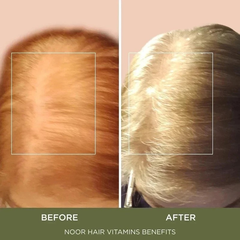3-Pack NOOR Healthy Hair Formula - NOOR Hair Growth Support Capsules - 180Caps gallery