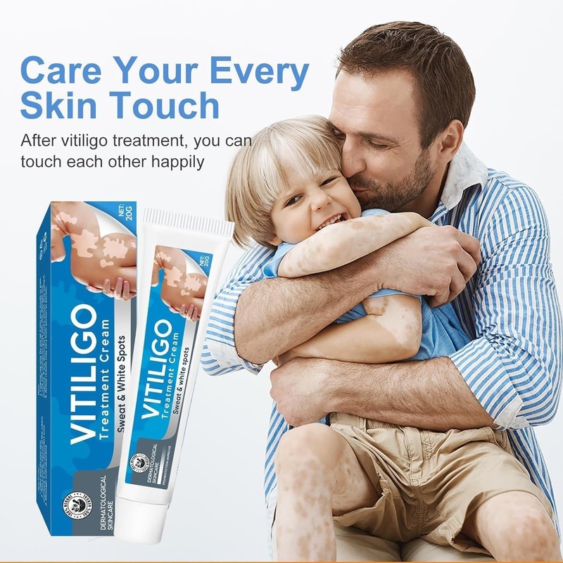 Vitiligo Treatment, Vitiligo Cream Improve Skin Pigmentation & Reduces White ... gallery