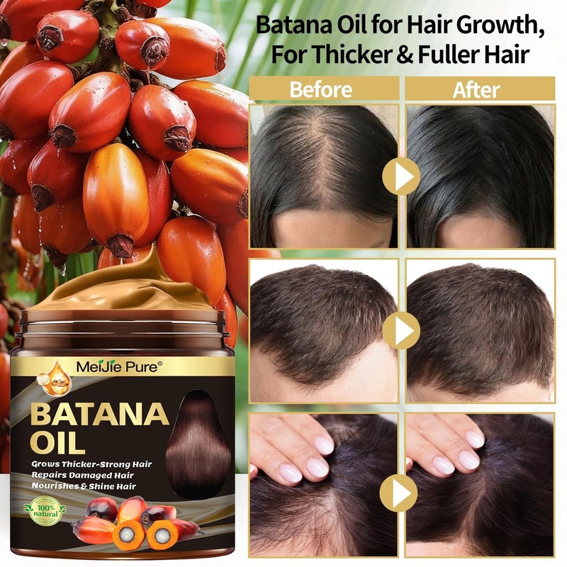 100% Raw Batana Oil for Hair Growth Thick Fuller Hair Scalp Treatment gallery
