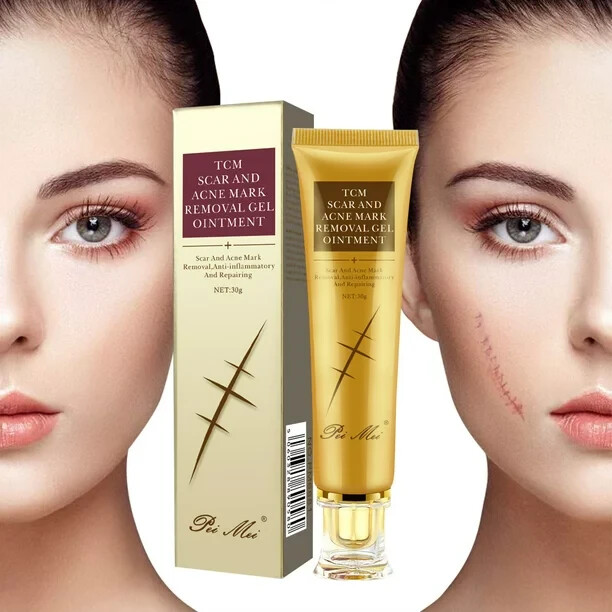 Scar and Acne Mark Removal Gel Ointment Remove Scars Burns Stretch Marks