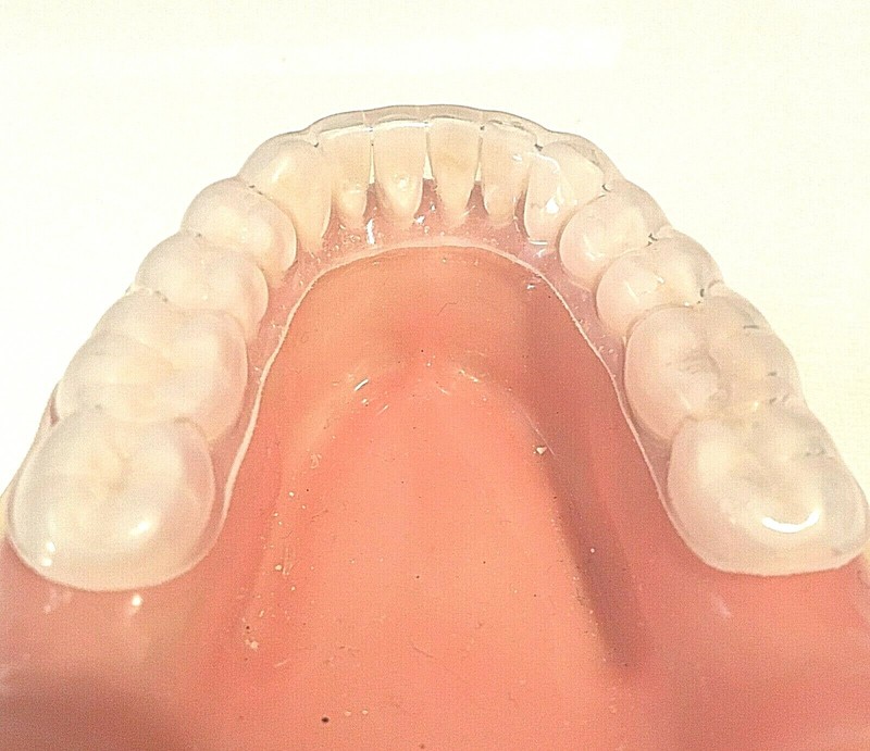 Dental Night Guard ~ Custom Fitted Teeth Grinding Direct from USA Dental Lab gallery