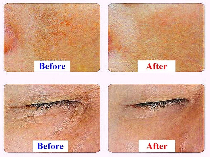 3N Miracle Shot: NK Stem Cell + NMN + NAD for Timeless Skin (24ml, 4 pieces) gallery