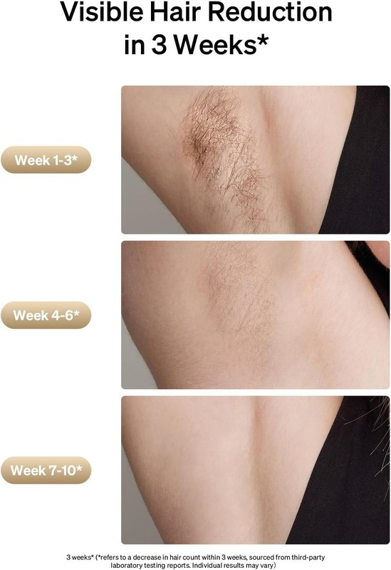 Ulike Laser Hair Removal, Air 3 IPL Hair Removal with Gift Set, Sapphire Ice-Co gallery