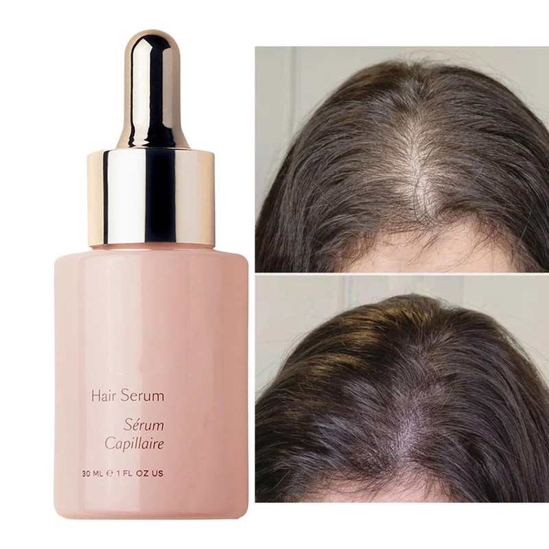Vegamour Gro Scalp Serum 1 Fl Oz 30ml For Thicker Scalp Care gallery