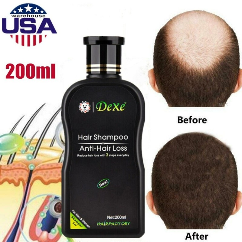 DEXE Anti-Hair Loss Shampoo Chinese Herbal Hair Regrowth For Men & Women 200ml