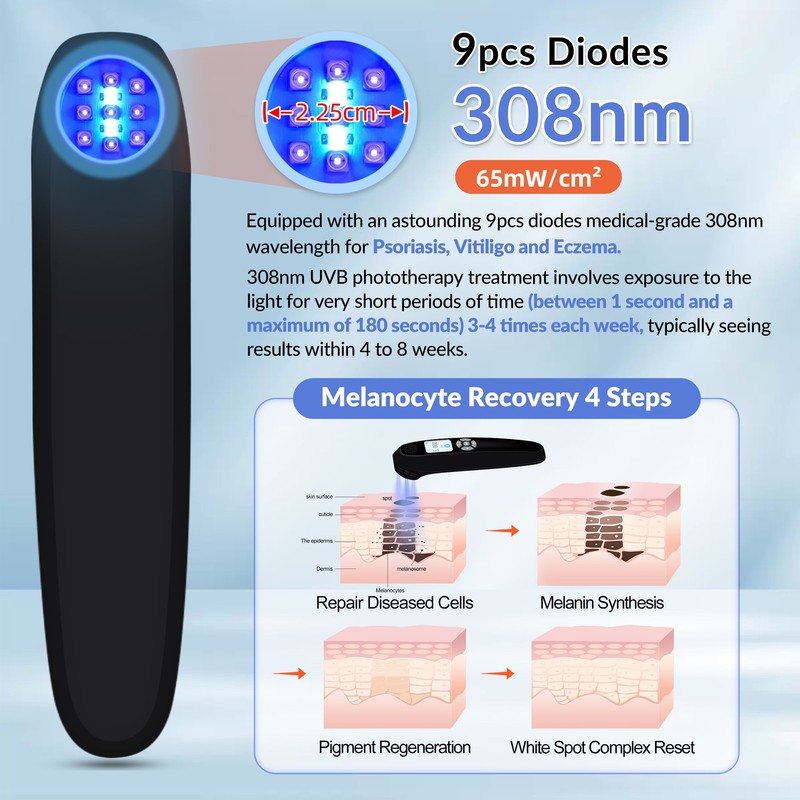 308nm UVB Light Therapy Device Face Hand Body Skin Treatment 9 Diodes 65mW/cm² gallery