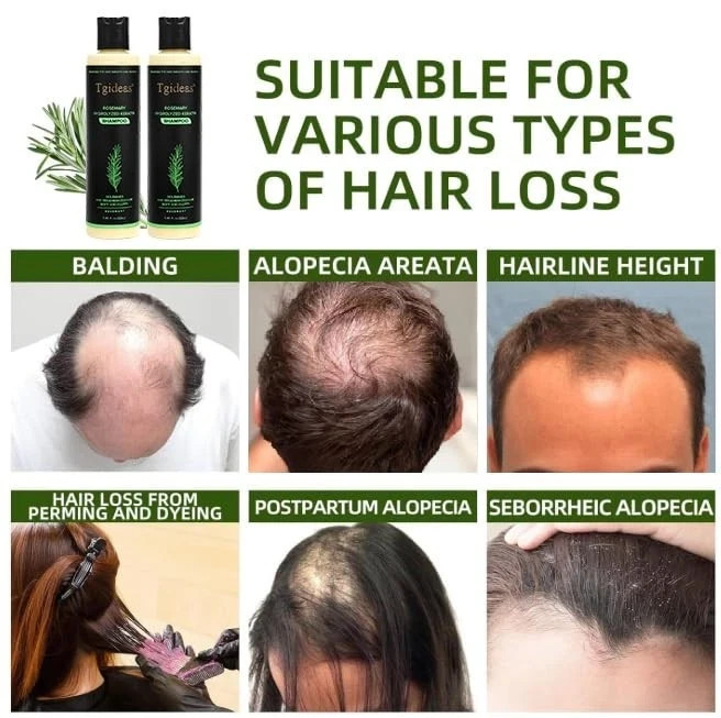 Tgideas Organic Rosemary Hair Growth Shampoo for Women and Men-Natural Thicke... gallery