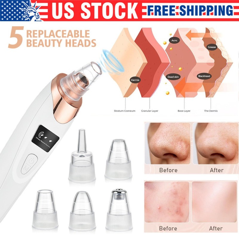 Electric Blackhead Remover Pore Nose Sucker Pimple Skin Acne Face Cleaner Vacuum gallery