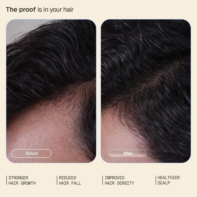 Hair Growth Serum for Women and Men - 4% Anagain,3% Redensyl,2% Baicapil - 30ml gallery