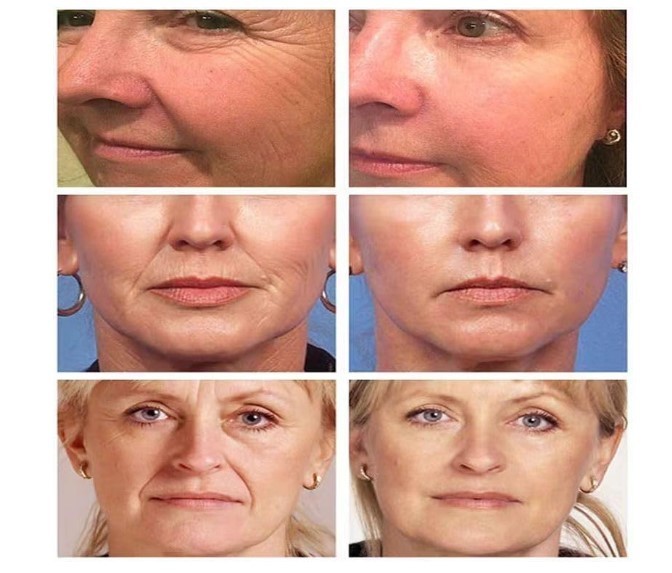 3 Pack Retinol & Peptide Tightening Cream for Smooth Firm-Looking Skin gallery