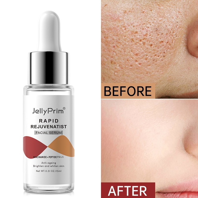 Pore Shrinking Dark Spots Face Serum Whitening For Glowing Niacinamide Hyaluroni