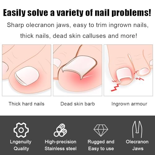 Toenail Clippers for Thick Toenails,Heavy Duty Ingrown Toenail Clipper for gallery