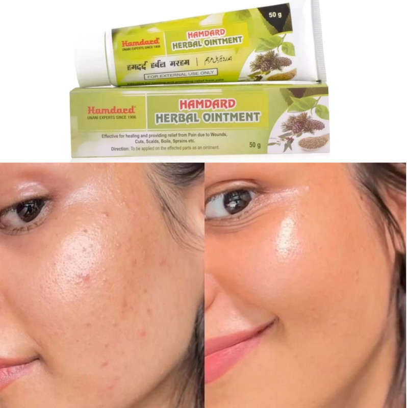 Hamdard Herbal Ointment (50g)Ointment for sprains, pimple, boils and cuts