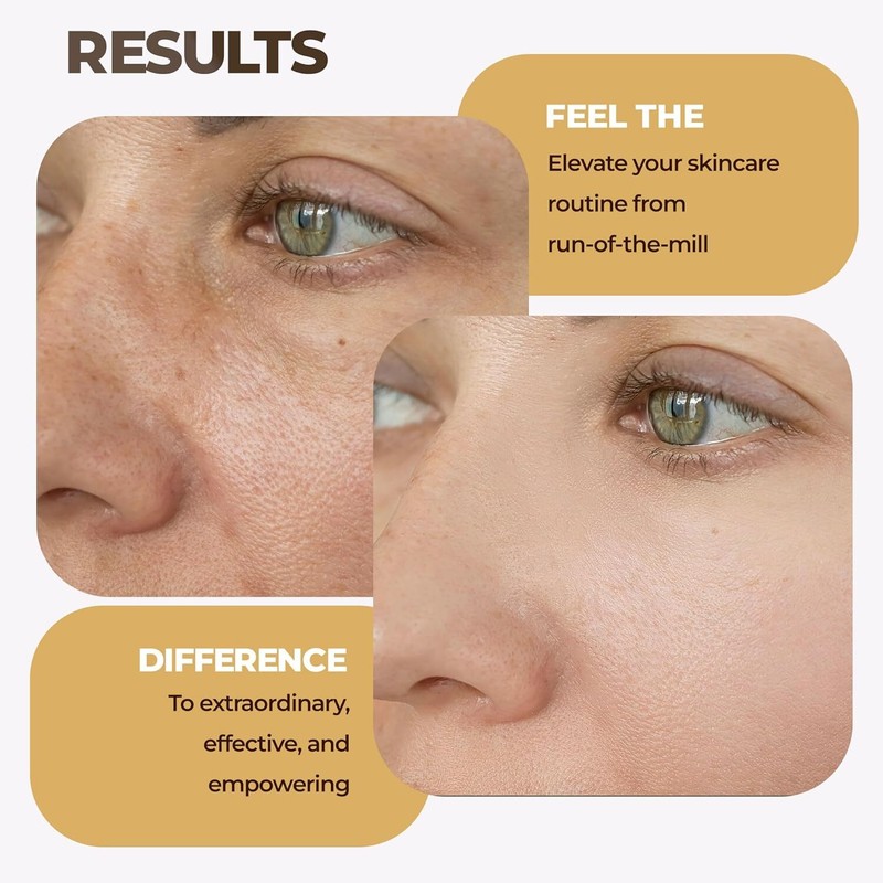 Advanced Bakuchiol Serum - Anti Aging Face Serum With Aloe Vera - 1 fl oz gallery