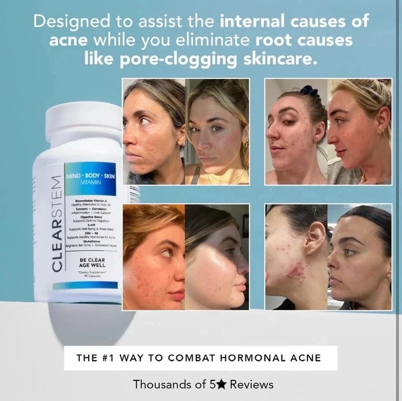 Clearstem (age+acne) MIND-BODY-SKIN Vitamin 90 Capsules gallery