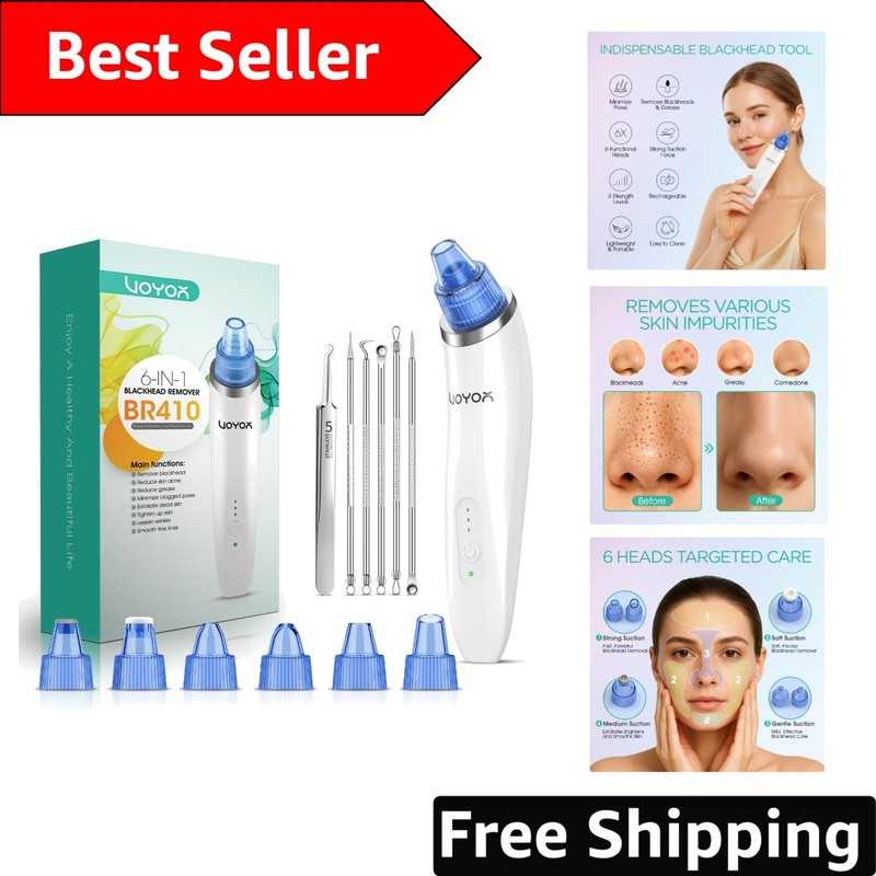Rechargeable Electric Pore Vacuum – Effective Blackhead & Whitehead Remover Tool