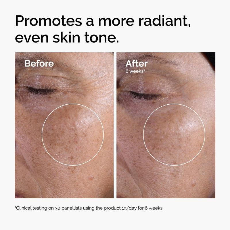 The Ordinary Glycolic Acid 7% Exfoliating Toner, Brightening and Smoothing Daily gallery