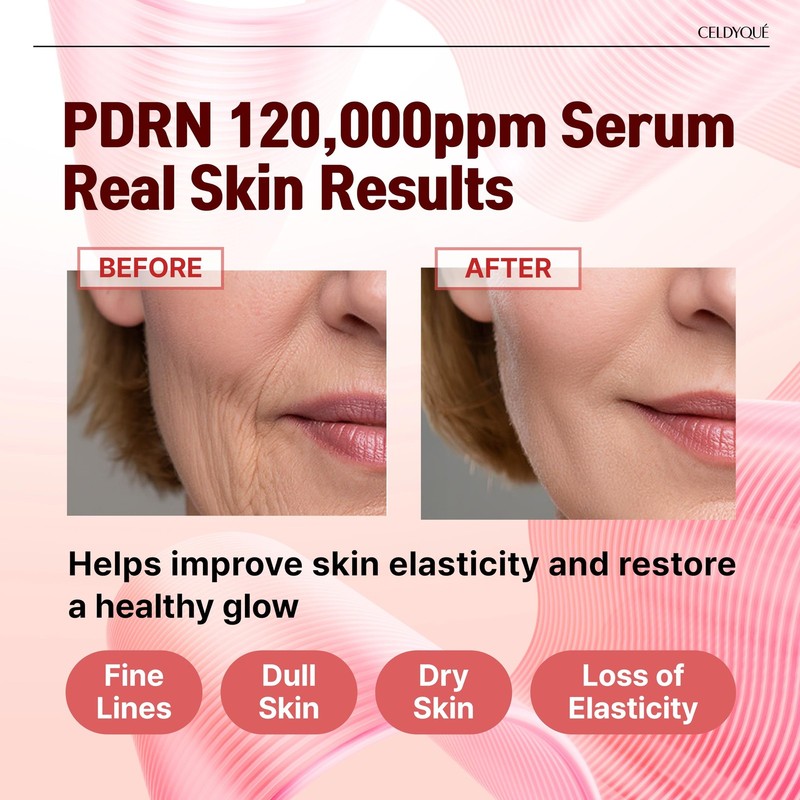 Salmon DNA PDRN 120,000 ppm EGF Peptide Microneedling Serum w/Volufiline, Phy... gallery