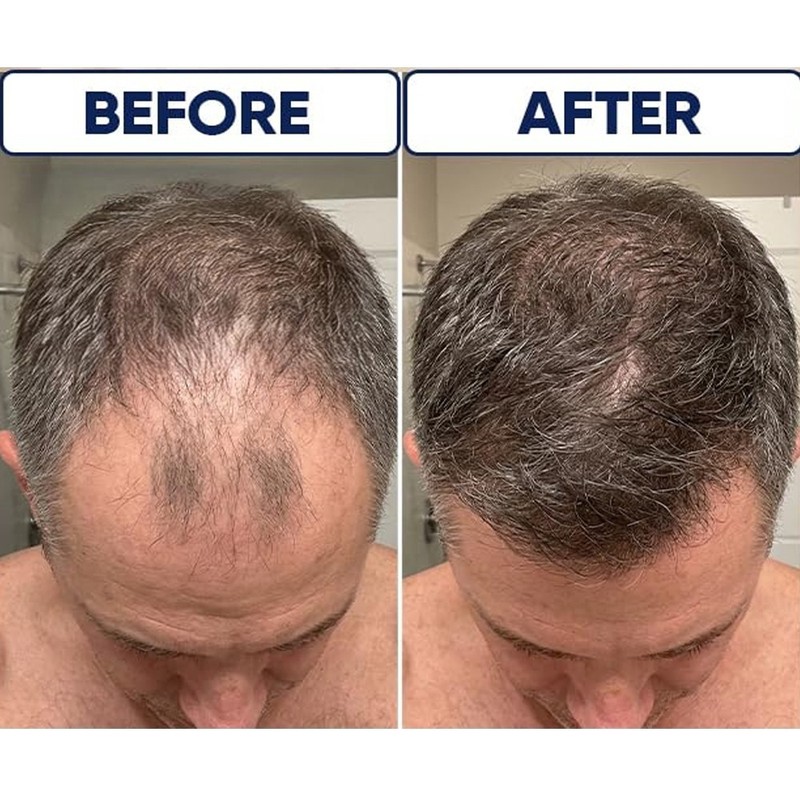 Organic Rosemary Natural Anti-Hair Loss Shampoo for Men and Women 1 pack - 100ml gallery