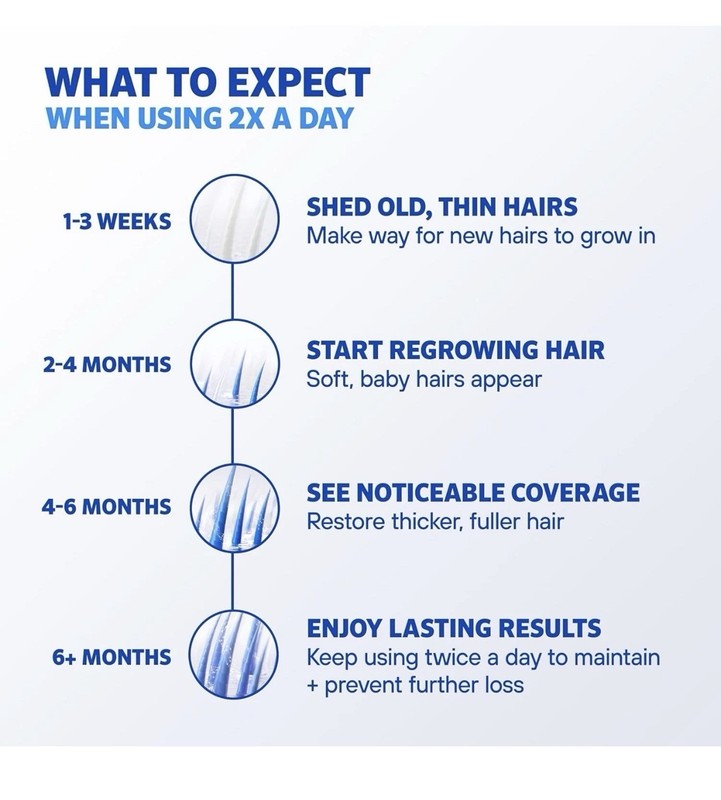 Men's Rogaine 5% Minoxidil Hair Regrowth Treatment Extra Strength 3 Bottles 60ml gallery