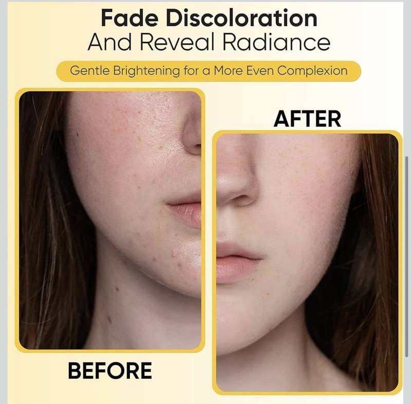 Turmeric Kojic Acid Cleansing Pads, 50 Pcs Exfoliating Cotton Rounds for Face gallery