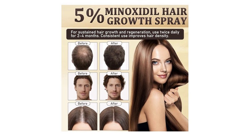 5% Minoxidil for Men & Women - Hair Growth & Beard Regrowth Biotin Serum with Ro gallery