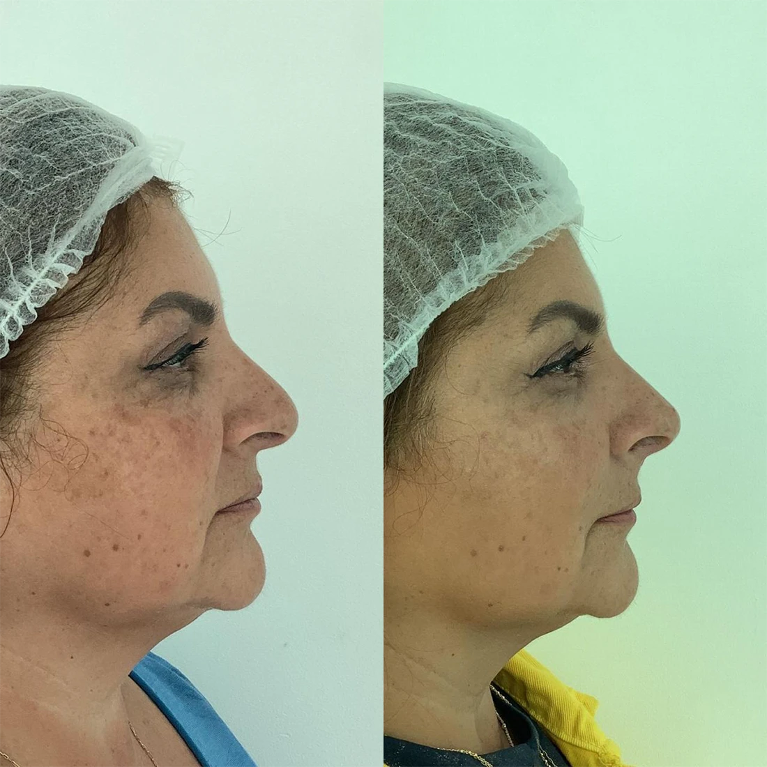 visage10.webp