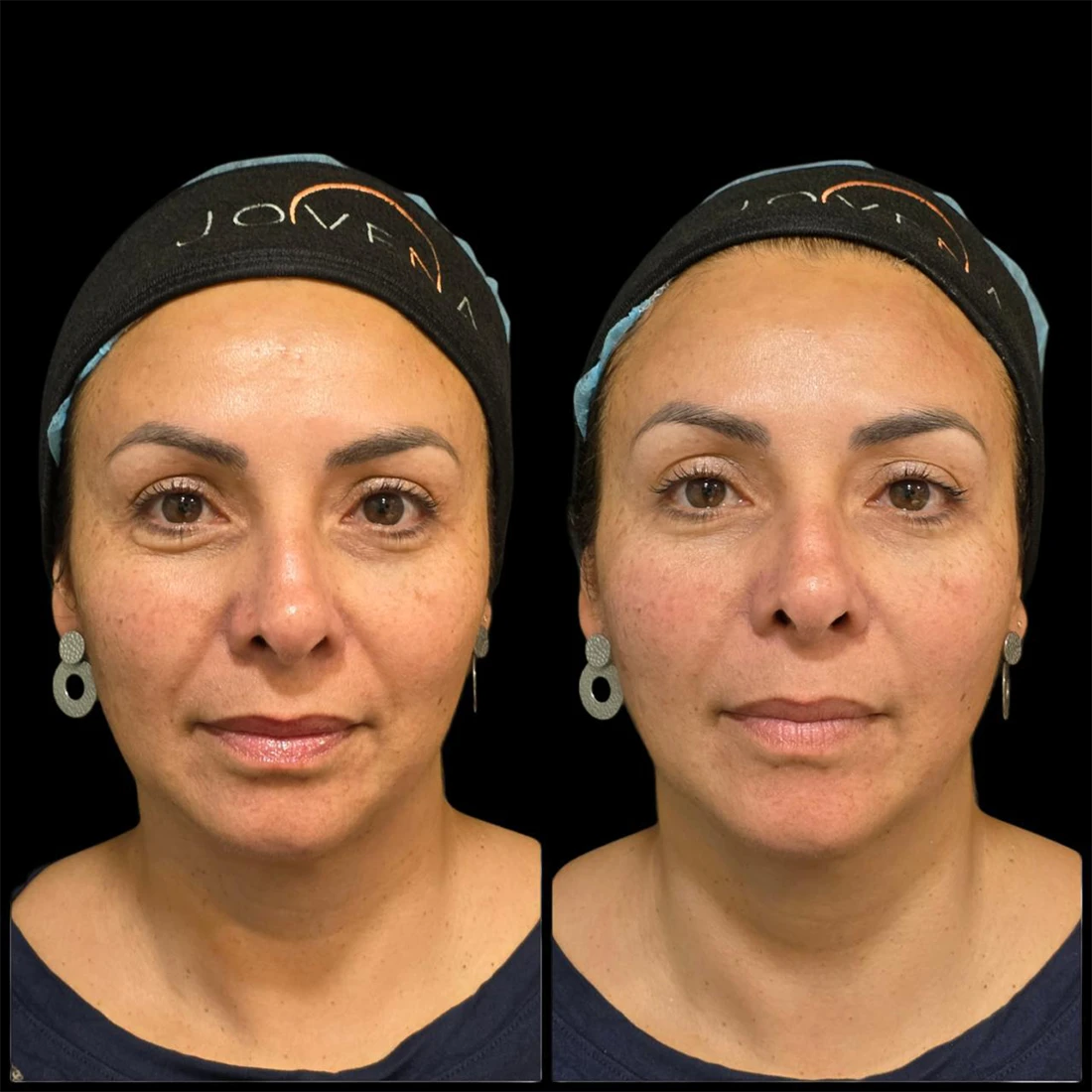 visage12.webp