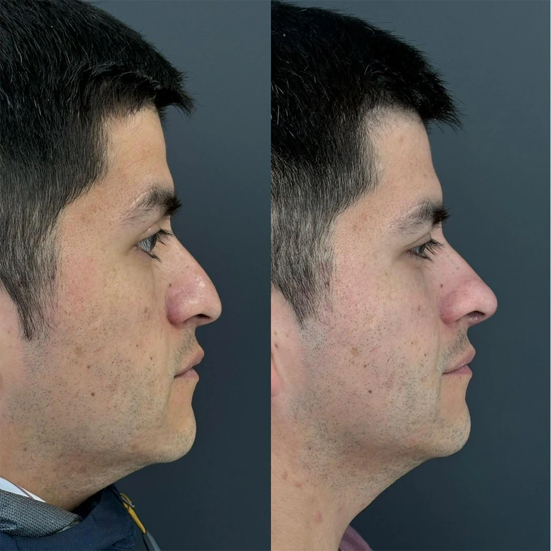 visage17.webp