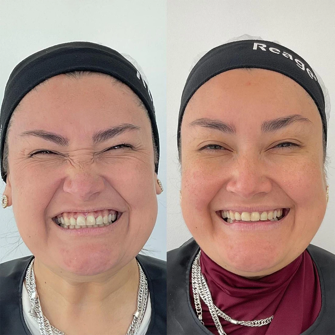 visage18.webp