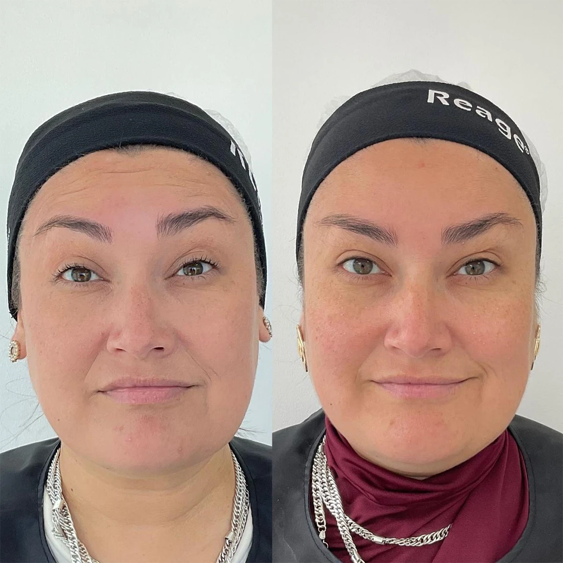 visage19.webp