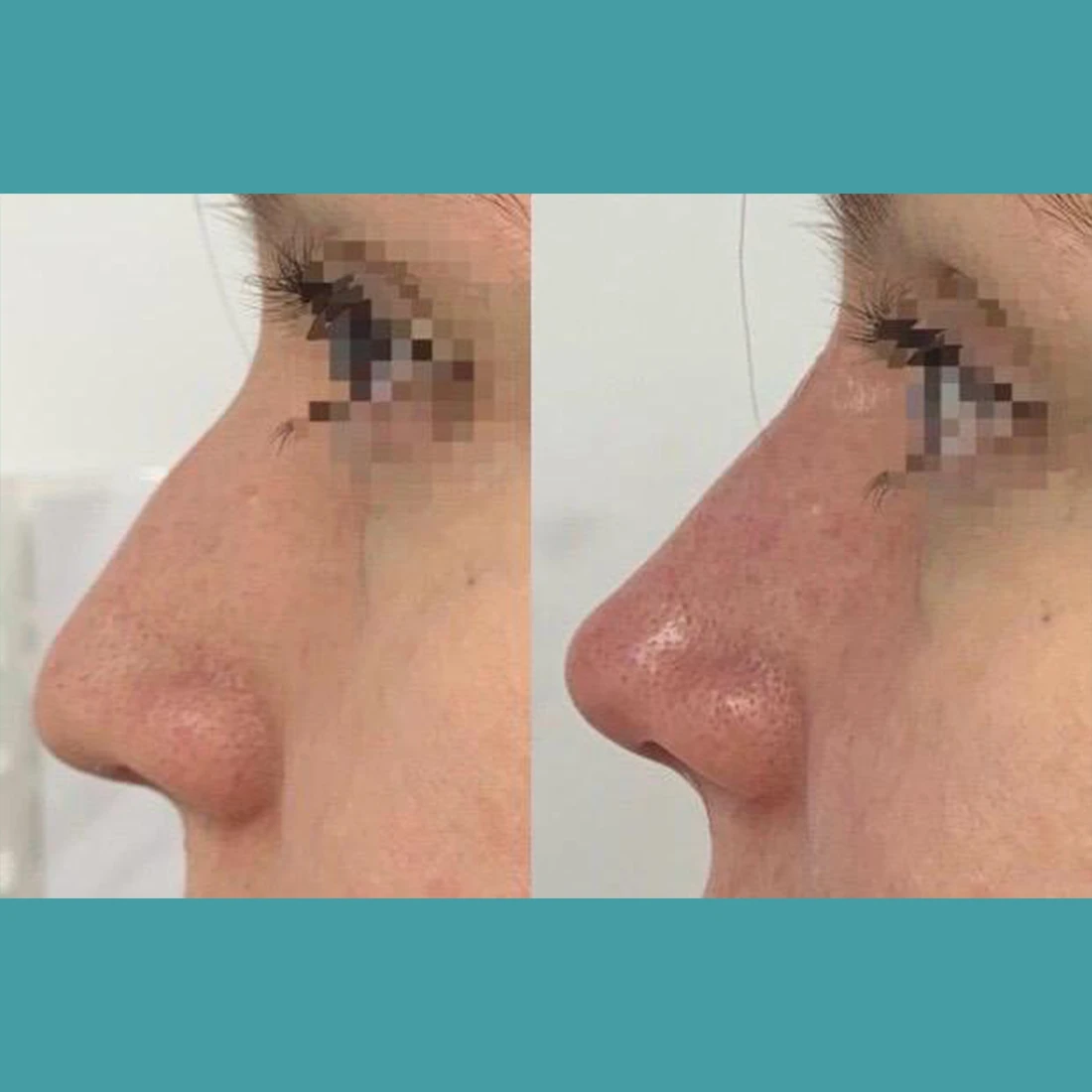 visage20.webp