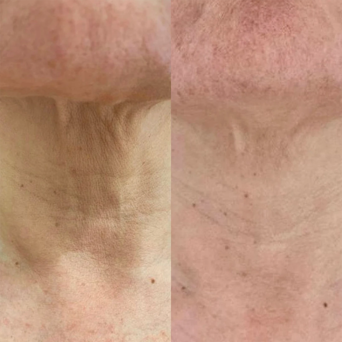 visage25.webp