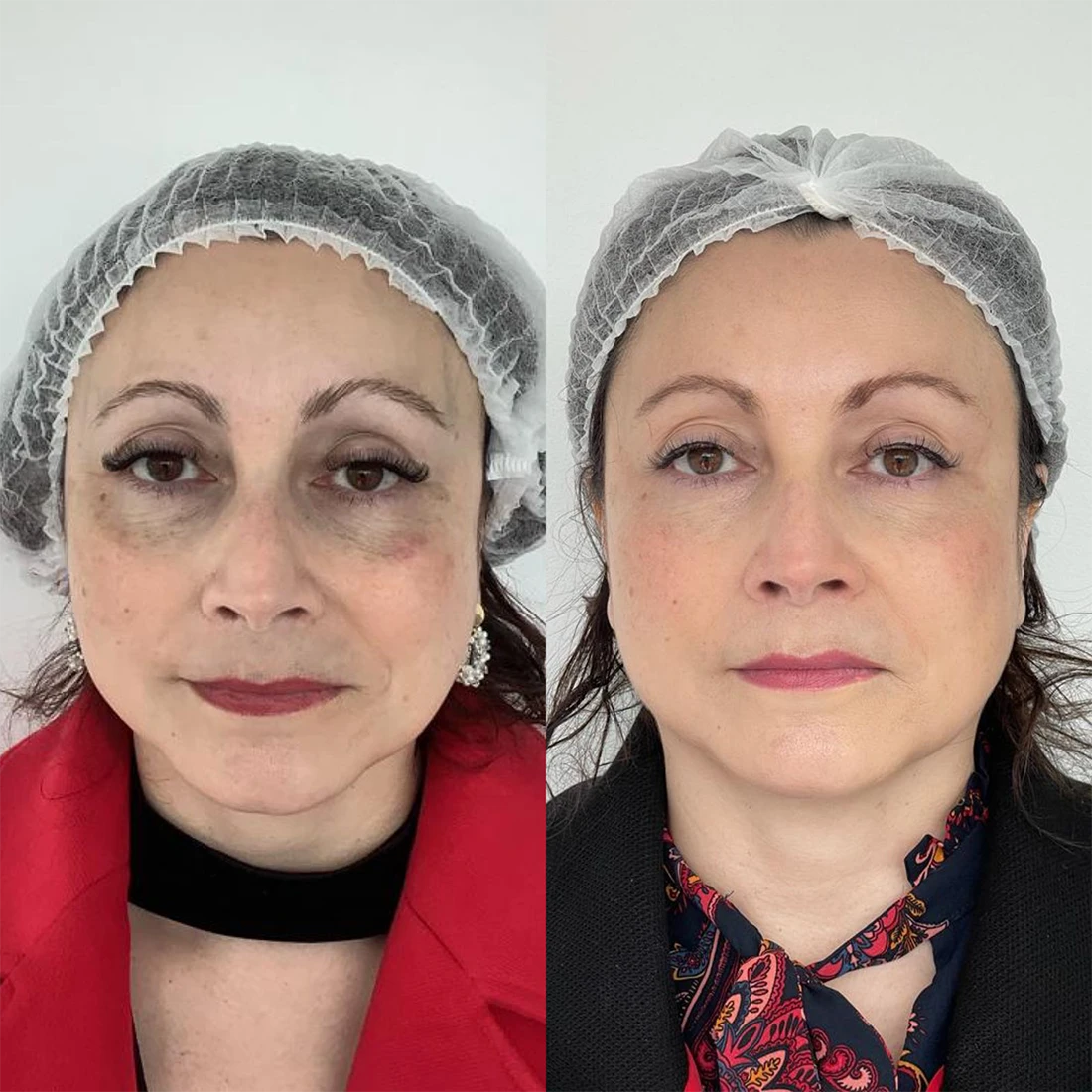 visage26.webp