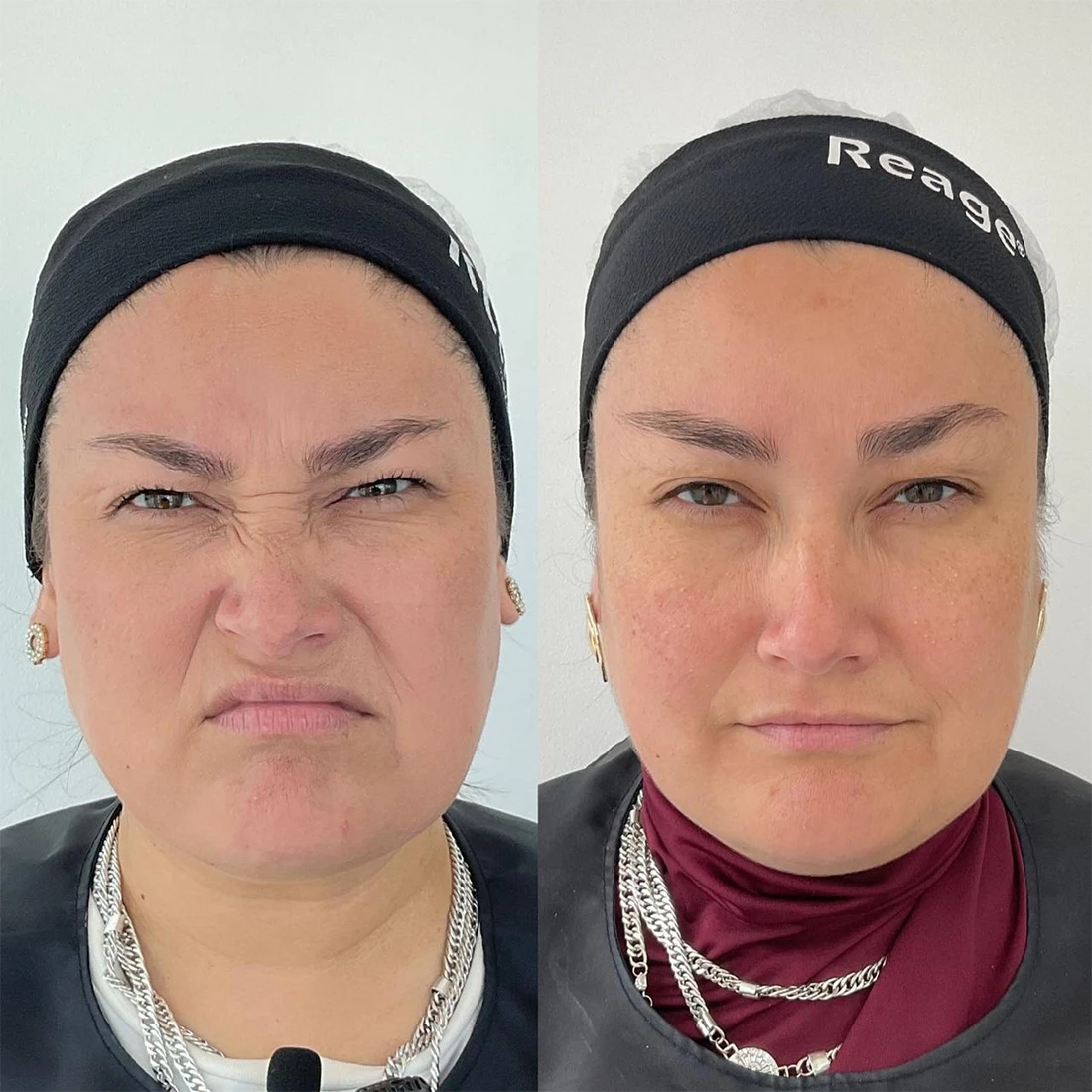 visage3.webp