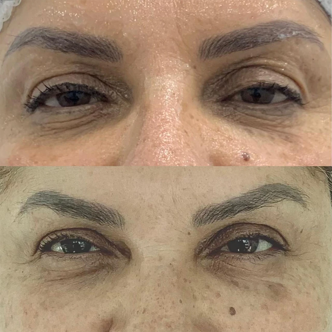 visage6.webp