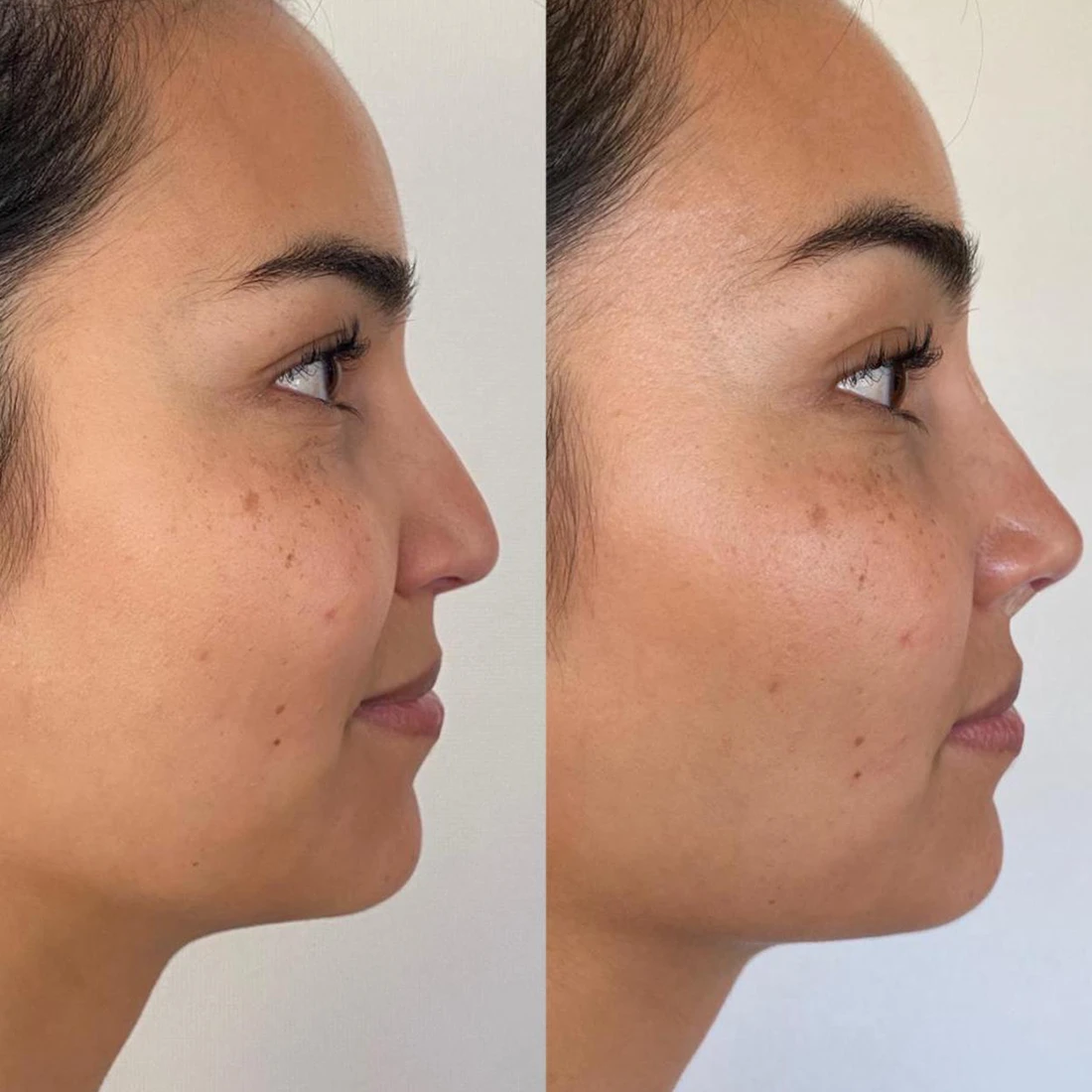 visage9.webp